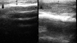 equine_ultrasound_Figure_2