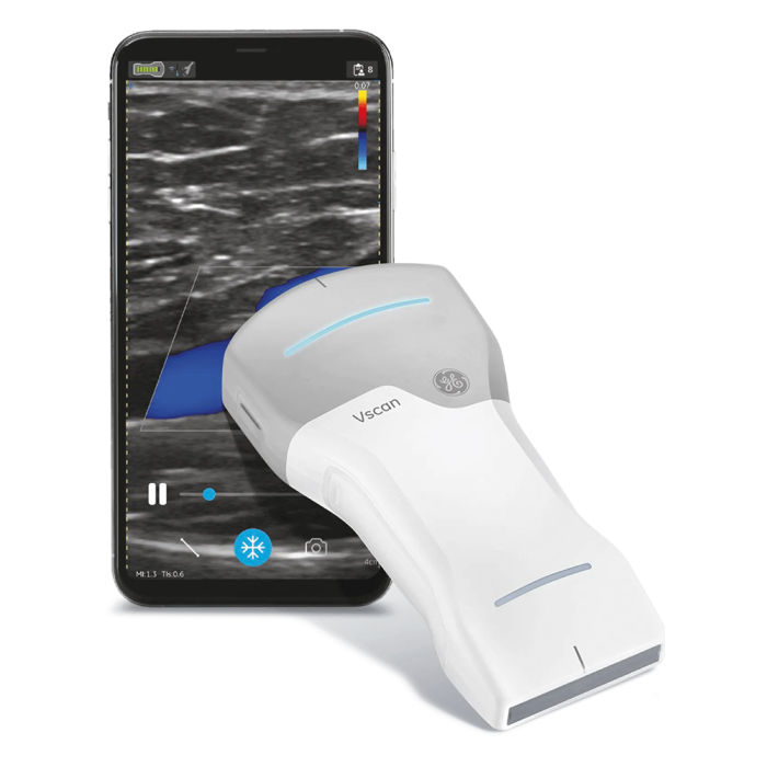 Handheld ultrasound vscan air