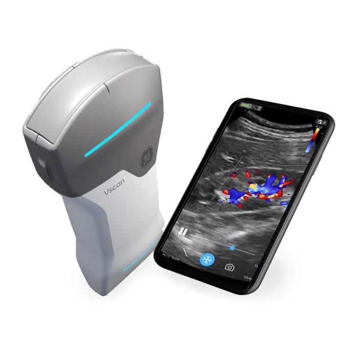 Handheld ultrasound vscan air